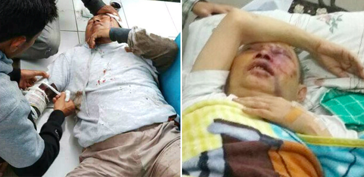 Fenomena Orang Diduga Gila Aniaya Ulama, Umat Harus Waspada