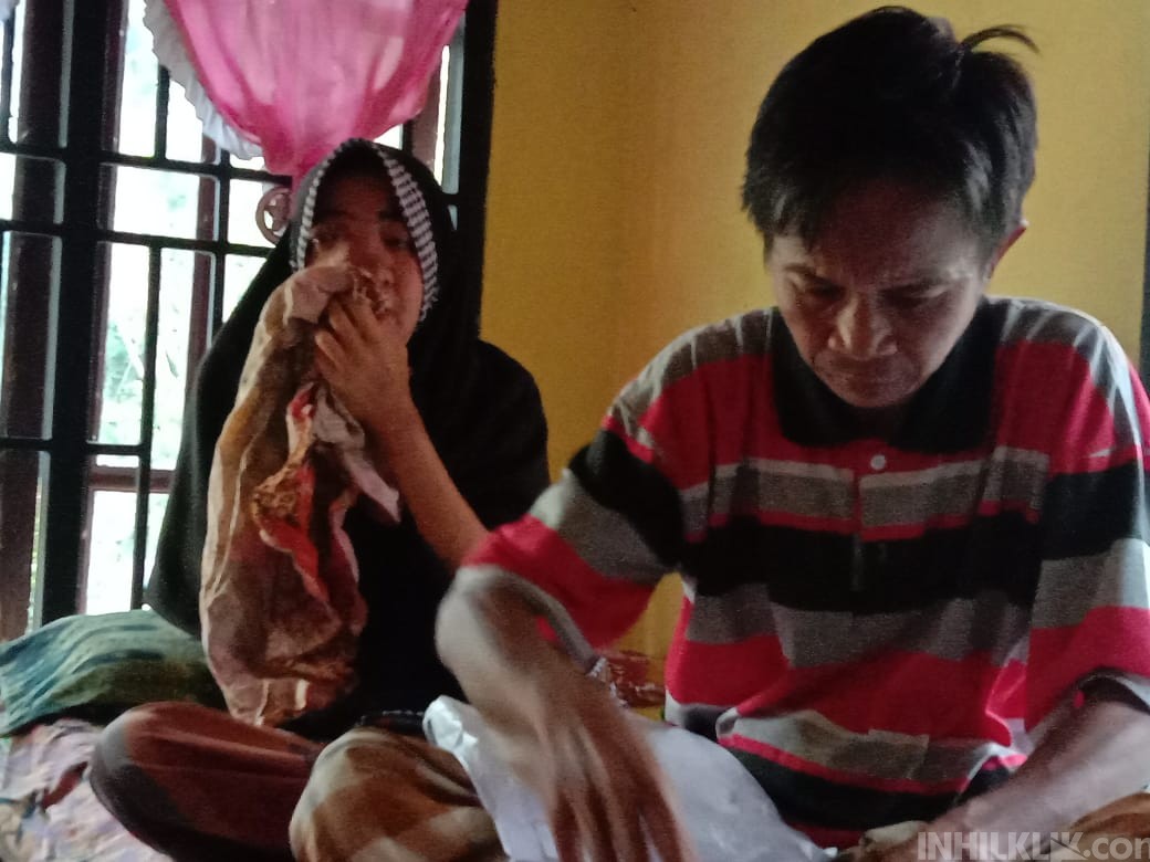 Warga Sergai ini Diduga Derita Tumor Hidung Butuh Uluran Tangan
