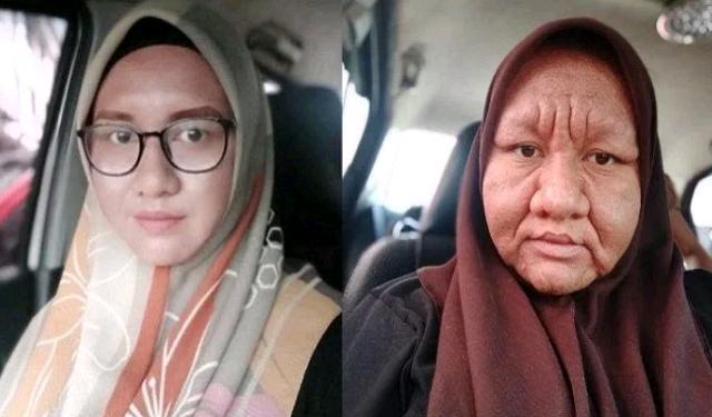 Hamil, Wajah Wanita Cantik Ini Mendadak Bengkak, Tebal dan Menghitam Mirip Nenek-nenek