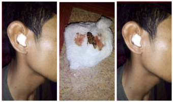 Periksa Kembali Jika Hendak Memakai Helm, Jangan Sampai Kejadian Ini Menimpamu