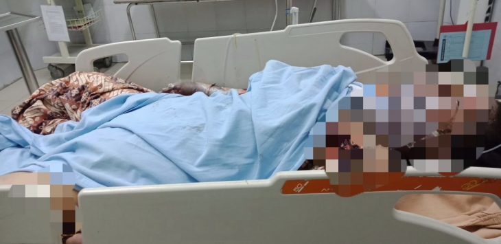 SADIS!!! Cemburu, Iwan Bakar Pacar Hidup-hidup