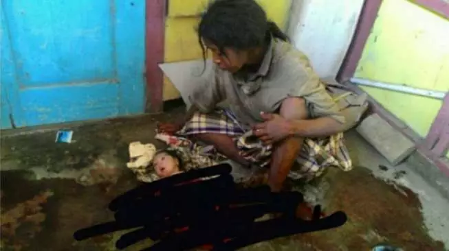 Seorang Gelandangan Gangguan Jiwa Melahirkan Sendiri Tanpa Bantuan