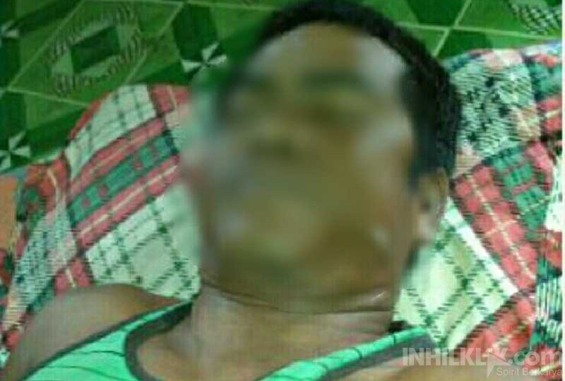 'OD' Obat Batuk, Seorang Pria di Inhil Tewas