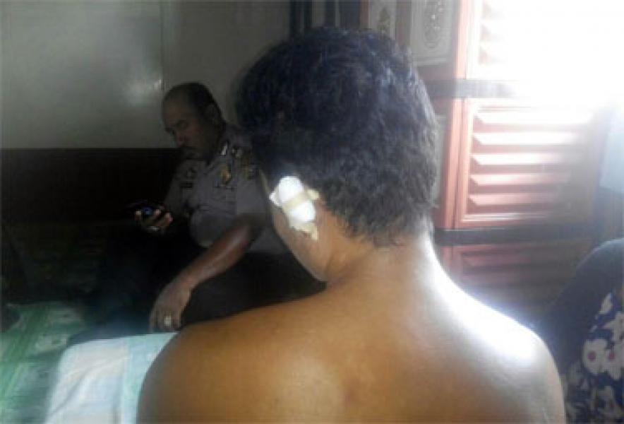 Dua Pemuda di Inhil Gigit dan Tikam Korbannya, Setelah Sebelumnya Berdamai