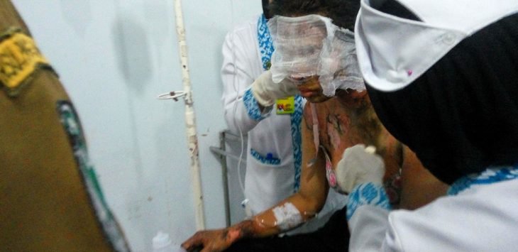 Pengakuan Gadis yang Nekat Bakar Diri di Depan Kekasihnya Itu…