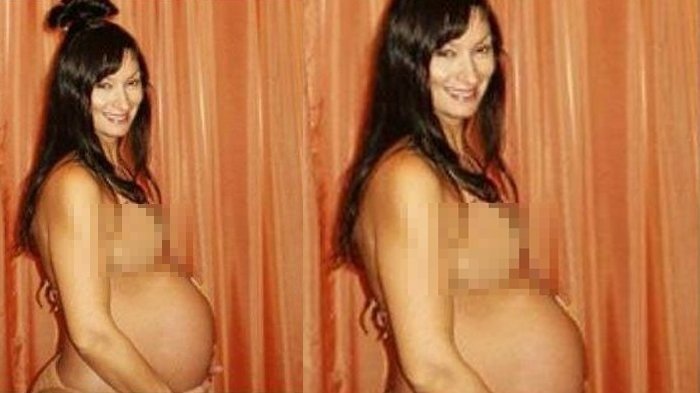 Demi Bisa Hamil, Wanita Ini Masukkan Ratusan Hewan Berlendir Ini ke Dalam Perut