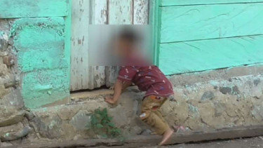 Bocah 3 Tahun di Gorontalo Tingkahnya seperti Anjing