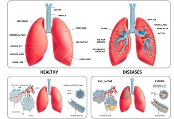 Cara Menjaga Organ Pernapasan Tetap Sehat dari Dinkes Inhil