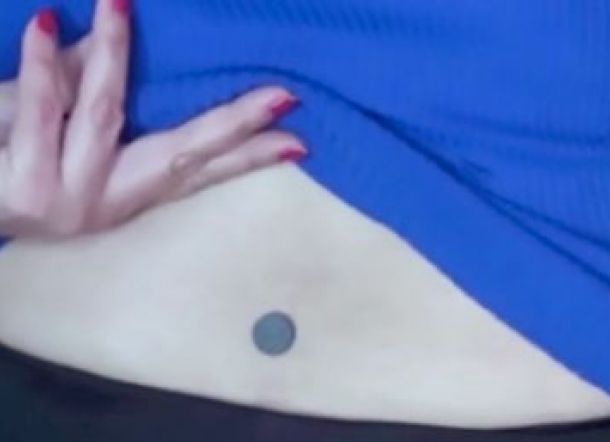 Wanita Ini Bisa Tempelkan Magnet di Punggungnya, Ternyata oh Ternyata ini Penyebabnya