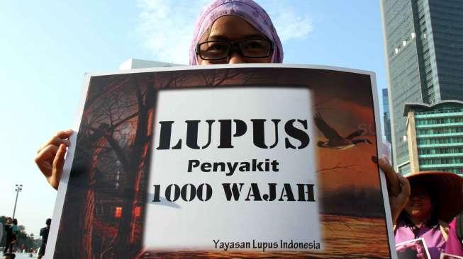 Ini Alasan Penyakit Lupus Disebut Sebagai Seribu Wajah