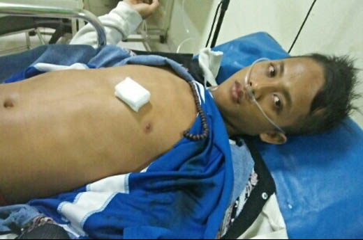 Seorang Remaja Ditikam OTK Saat Buang Air Kecil di Pulau Palas