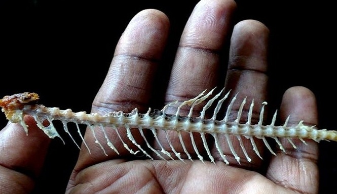 Ini Bahaya Minum Air Saat Tersedak Tulang Ikan