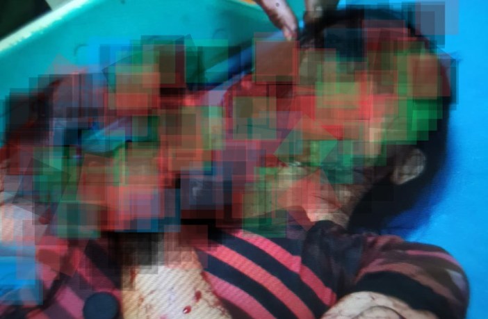 Satu Keluarga Perawat dan Anaknya Dibacok OTK di Rumah