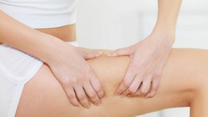 Seputar Selulit dan Tiga Kunci Penting Agar Kulit Tetap Kencang
