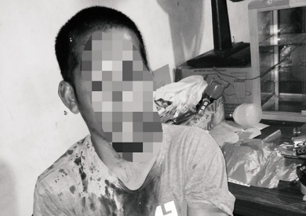 Bergulat Dengan Perampok, Pria di Inhil ini Luka 19 Jahitan