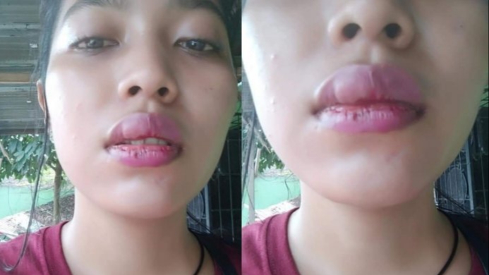 Sambil Menangis Anak Gadis Penjual Tuak Curhat di Medsos: Mama Saya Diarak dan Diikat di Pohon