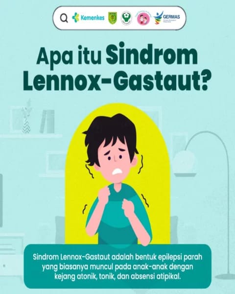 Dinkes Inhil: Kenali Epilepsi SLG, Ini Gejala dan Cara Penanganannya