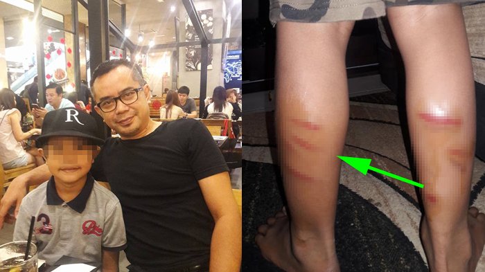 Viral! Ayah Curhat Anaknya Dihukum Guru, Bekas Pukulan Penuhi Kaki, 'Hatiku Hancur & Aku Menangis'