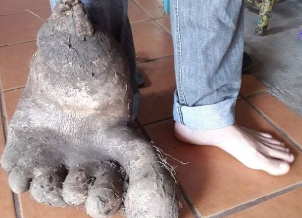 Kentang Raksasa Berbentuk Kaki Manusia