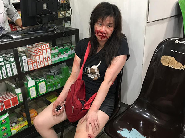 Perampok Nekat Beraksi Siang Bolong, Wanita Tionghoa Ini Disekap dan Ditikam di Dalam Mobil
