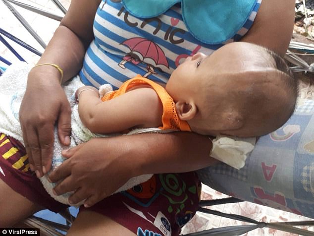 Ditinggal Orang tua nya saat Sakit Keras, Kejadian yang Menimpa Bayi ini Bikin Pilu