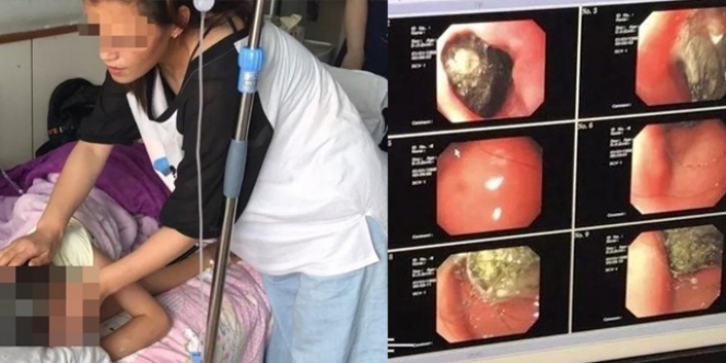 Alami Kebotakan Aneh, Isi Perut Bocah Ini Bikin Terbelalak