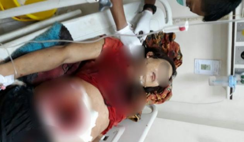 SEREM... Cemburu, Puput Dibacok Pacar LGBT Pakai Golok, Usus Terburai
