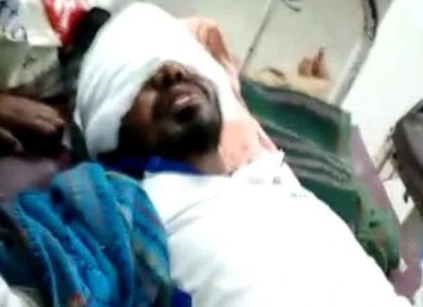 Cinta Ditolak, Si Gadis Siramkan Larutan Asam pada Pria Pujaan Hatinya