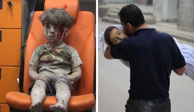 Lima Kisah Sedih Anak Korban Perang Suriah yang Bikin Dunia Menangis