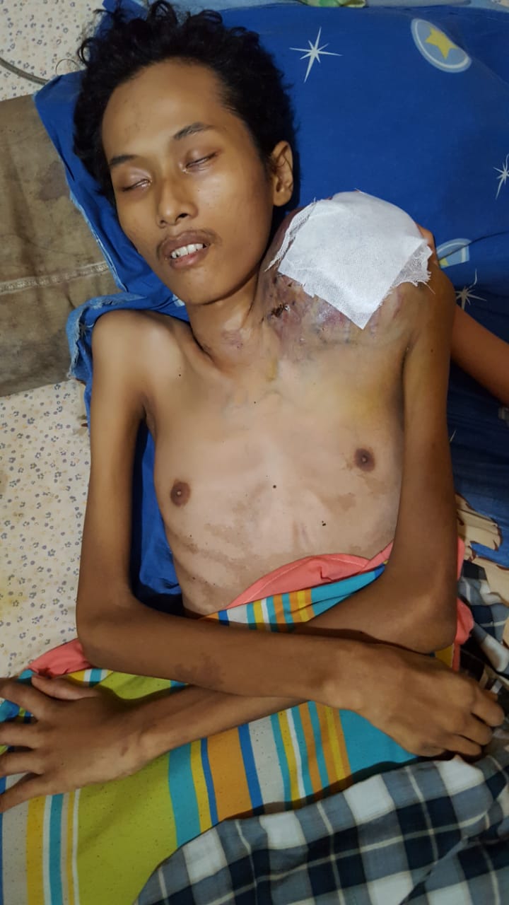 Rafii Putra, Penderita Osteosarcoma Butuh Uluran Tangan