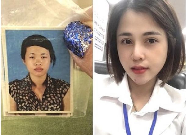 Diputuskan karena Jelek, Wanita Ini Operasi Plastik, Mantan Klepek-klepek