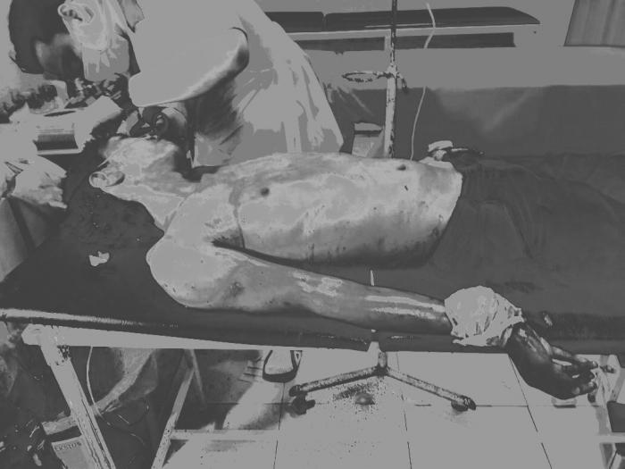 Pria Di Inhil Terluka Parah Setelah Bertarung Hebat Dengan Sahabatnya Sendiri