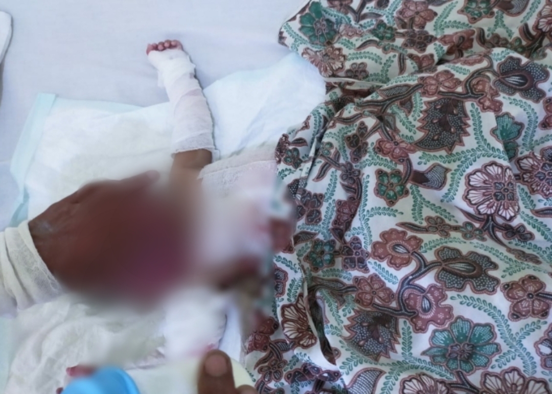 Miris, 1 Keluarga di Inhil Terbakar di Pondok, Kondisi Bayi 10 Bulan Bikin Sedih