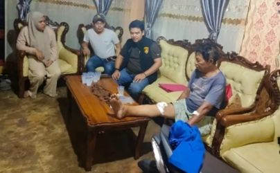 Begini Kondisi Korban Tabrak Lari di Pekanbaru, Dapat 20 Jahitan di Kaki