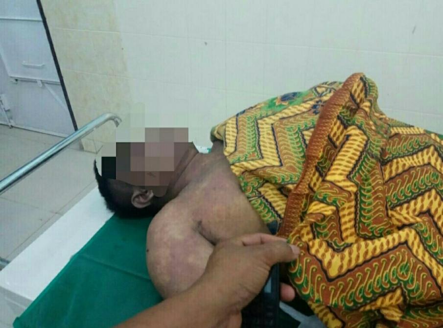 Pekerja Hotel Cititel Dumai Ditemukan Tewas