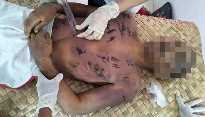 Dituduh Curi Singkong, La Gode Tewas di Markas Tentara, Tubuh Luka-luka, 8 Gigi Hilang, Kuku Kaki Tercerabut