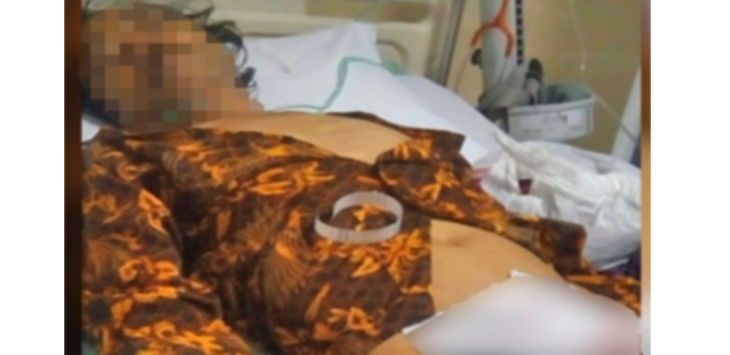 Owalah.. Pria 55 Tahun Ini Nekat Potong Anunya Sendiri, Diduga Depresi