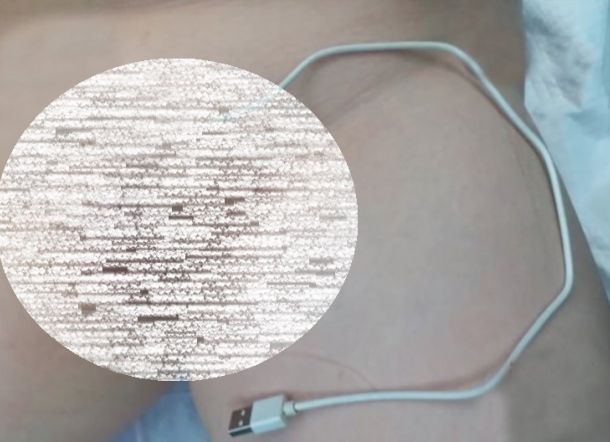 Astaga!!! Bocah ini Masukkan Kabel USB ke Penisnya, Ini yang Terjadi Selanjutnya...