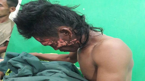 Seorang Pekerja Tersengat Listrik Saat Memasang Tenda